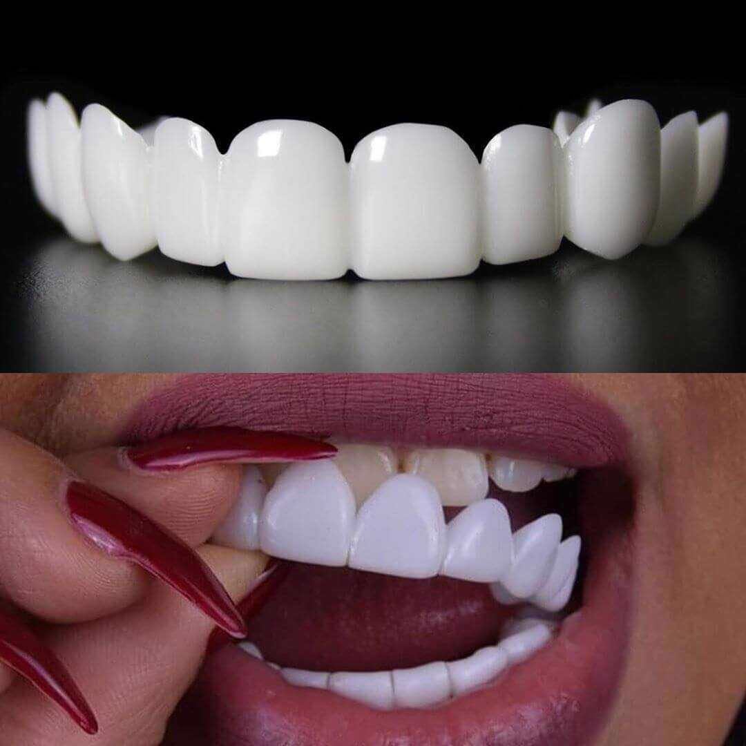Snap On Smile Teeth Decoration Kit