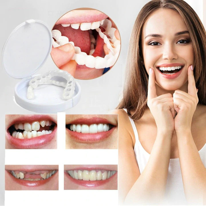 Snap On Smile Teeth Decoration Kit