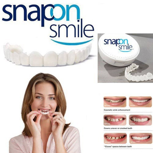 Snap On Smile Teeth Decoration Kit